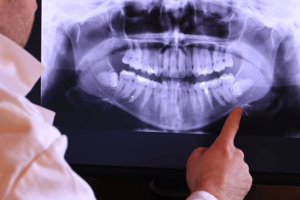 Best Emergency Treatment for Oral Infections in Ocean Acres, NJ